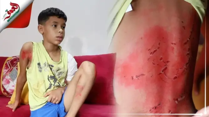 المتهم على خلاف مع أب الضحية..كلاب شرسة تفترس طفلا بالبيضاء والأم تدعو لإنصافها بعد فرار الفاعل
