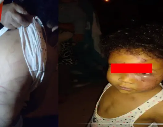 أكادير: أم تعذب طفلتها بالكي.. والجيران يكشفون تفاصيل خطيرة(فيديو)