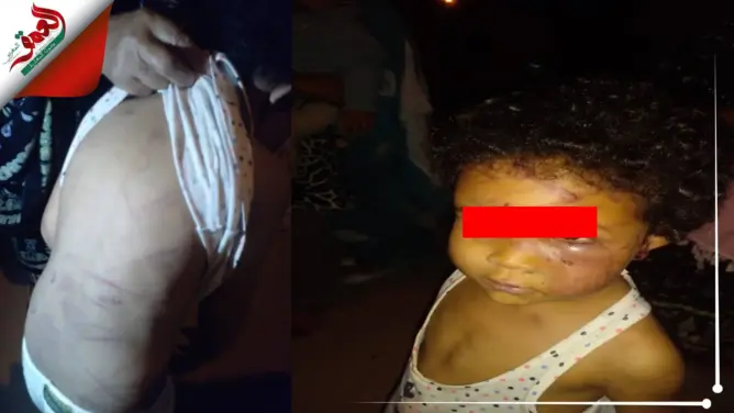 أكادير: أم تعذب طفلتها بالكي.. والجيران يكشفون تفاصيل خطيرة(فيديو)