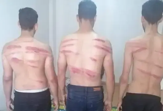 بعد تعذيبهم من طرف حرس الحدود اليوناني.. 13 مغربيا يتلقون العلاج بتركيا