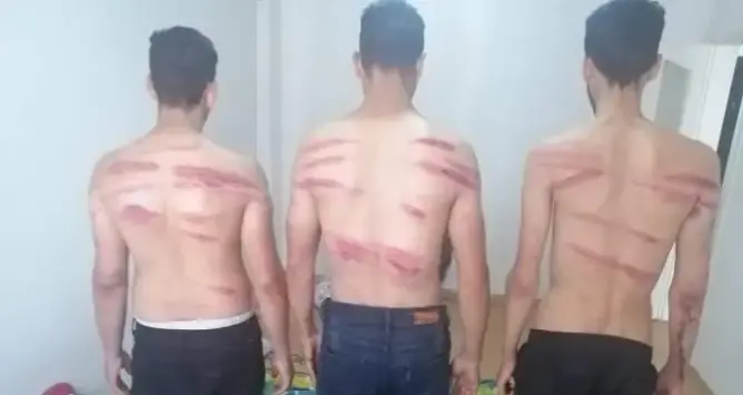 خاص – مصرع مغربي بفعل التعذيب في اليونان وآخرون يتعرضون لتعنيف وحشي (صور)