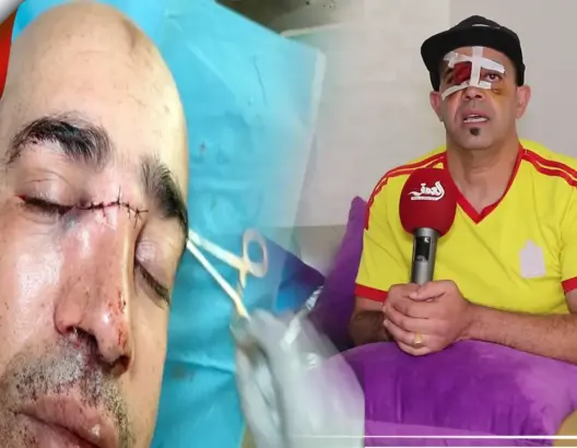 فاعل جمعوي يتعرض لاعتداء بمكناس.. ومركز حقوقي يدخل على الخط (فيديو وصور)