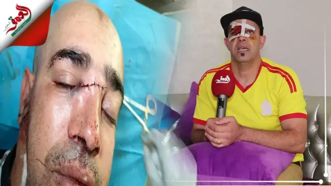 فاعل جمعوي يتعرض لاعتداء بمكناس.. ومركز حقوقي يدخل على الخط (فيديو وصور)