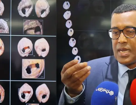 يعود تاريخها لـ150 ألف سنة.. باحث مغربي يتحدث عن قواقع كانت تستعمل كحلي للزينة (فيديو)