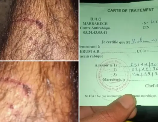 بعد أم وابنتها.. الكلاب تهاجم مواطنا والظاهرة تستفحل بمدينة مراكش