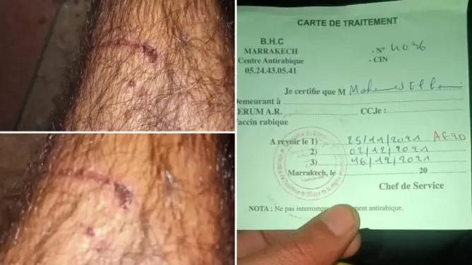 بعد أم وابنتها.. الكلاب تهاجم مواطنا والظاهرة تستفحل بمدينة مراكش