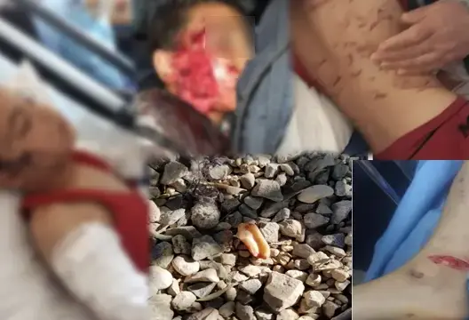 خطير.. كلاب بيتبول تنهش جسم طفل داخل مؤسسة تعليمية !!