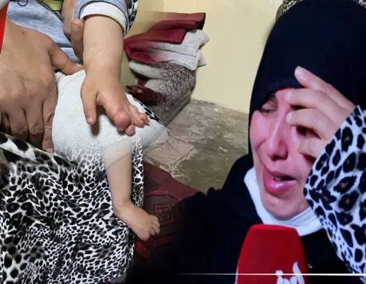 طفلة وُلدت بأصابع متلاصقة في يديها ورجليها .. ووالدتها تناشد ذوي القلوب الرحيمة (فيديو)
