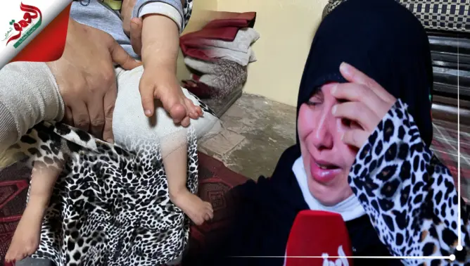 طفلة وُلدت بأصابع متلاصقة في يديها ورجليها .. ووالدتها تناشد ذوي القلوب الرحيمة (فيديو)