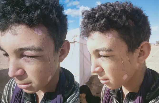 رحل بالرشيدية يشتكون “اعتداءات” جنود حدود .. وحقوقيون يطالبون بفتح تحقيق