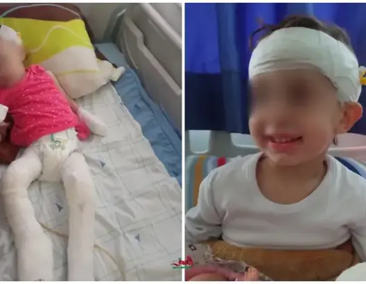 إيناس الخراز.. قصة رضيعة بشفشاون مليئة بالآلام و”أنقذوا إيناس” يغزو مواقع التواصل (صور)