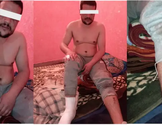 بسبب انتمائه الإيديولوجي.. الاعتداء على طالب بالحي الجامعي بني ملال (صور)