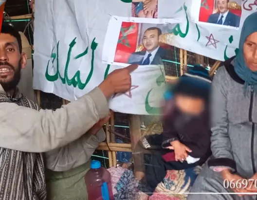 طفل يفقد عضوه الذكري بعد عملية ختان .. والأب يحكي تفاصيل المريرة مع حجام وطبيب وردهات المحاكم