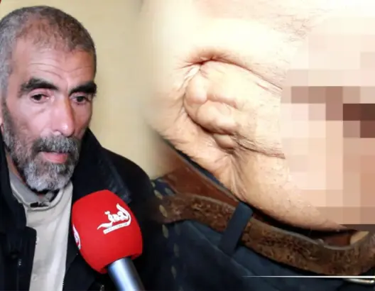 لازالت شظاياها في جسمه.. جندي سابق يحكي عن إصابته بقذيفة هاون ويناشد الملك (فيديو)