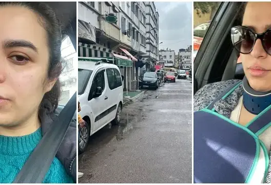البيضاء.. شابة تتهم صاحب مقهى بتعنيفها بعد ركن سيارتها أمام المقهى