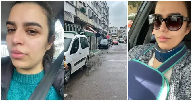 البيضاء.. شابة تتهم صاحب مقهى بتعنيفها بعد ركن سيارتها أمام المقهى