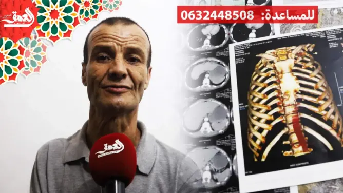 ناشد المحسنين التدخل لعلاجه.. مرض السرطان يُحول حياة رب أسرة بطنجة إلى جحيم