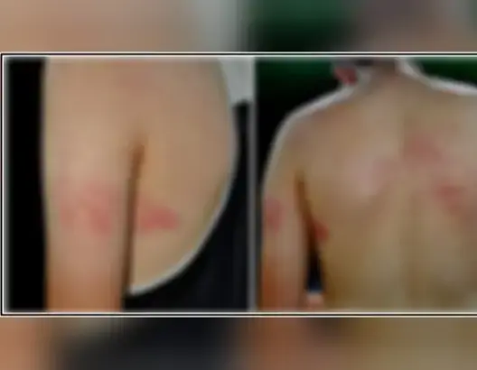 العنف الطلابي يتواصل.. اختطاف طالب بالناظور والاعتداء عليه بعد تجريده من ملابسه