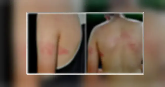 العنف الطلابي يتواصل.. اختطاف طالب بالناظور والاعتداء عليه بعد تجريده من ملابسه