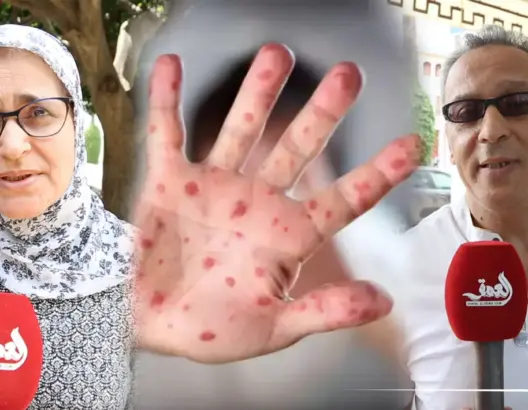 هل يتكرر سيناريو “كورونا” أم مجرد مرض عادي؟.. هكذا تفاعل مغاربة مع “جدري القردة” (فيديو)