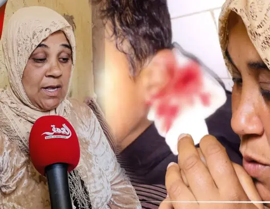 كلاب مسعورة تلتهم طفلا بحد السوالم.. ووالدته: “كلاوه قدامي والدرك مدار معايا والو” (فيديو)