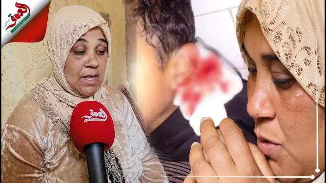 كلاب مسعورة تلتهم طفلا بحد السوالم.. ووالدته: “كلاوه قدامي والدرك مدار معايا والو” (فيديو)