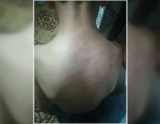 أستاذة تعتدي على تلميذ بالفقيه بنصالح والمدير يمنعه من متابعة الدراسة بعد لجوء عائلته للقضاء