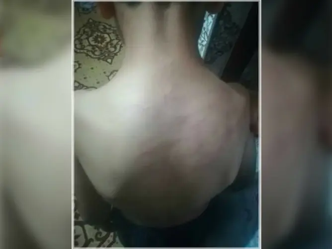 أستاذة تعتدي على تلميذ بالفقيه بنصالح والمدير يمنعه من متابعة الدراسة بعد لجوء عائلته للقضاء