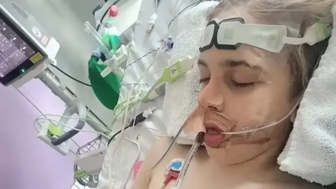 معركة قانونية تعجل بوفاة طفل بريطاني بعد فصله عن أجهزة الإنعاش
