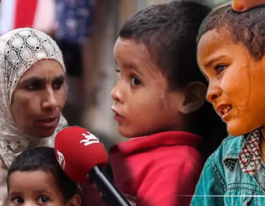 ندوب كبيرة تغطي وجهه.. عائلة الطفل “سلمان” تناشد المحسنين لاجراء عملية التجميل