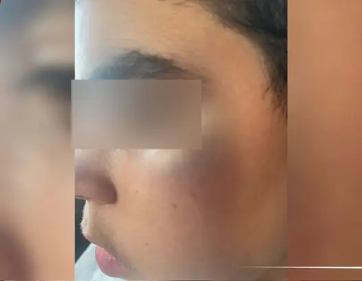 العرائش .. عائلة تشتكي تعنيف طفلها بمؤسسة خاصة