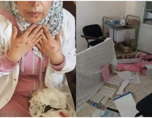 الاعتداء على ممرضة يخرج نقابات صحية للاحتجاج بتاونات