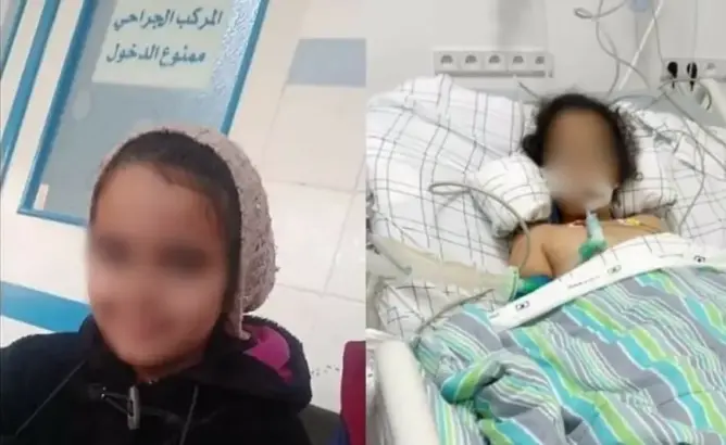 عملية لاستئصال اللوزتين بمشفى المضيق تتحول لمأساة.. طفلة تصارع الموت والملف يصل البرلمان