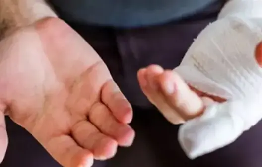 نائب رئيس مقاطعة بفاس يعتدي على موظف بقضم إبهامه