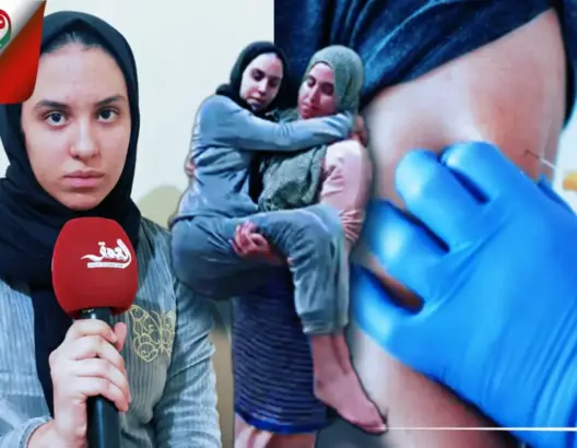 إصابة طفلة بالشلل بعد تلقيها لقاح كورونا