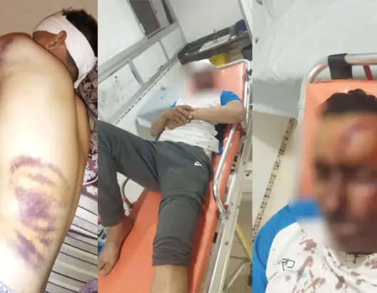شكوك وراء عدم توقيف متهمين بالاعتداء على شاب بالرحامنة .. والعائلة: دُهسنا وكأننا حشرة