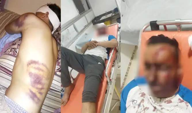 شكوك وراء عدم توقيف متهمين بالاعتداء على شاب بالرحامنة .. والعائلة: دُهسنا وكأننا حشرة