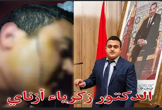استنكار بوجدة بعد الاعتداء على دكتور جامعي قبيل اجتيازه مباراة للتوظيف