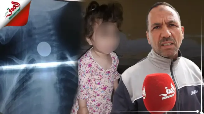 وفاة رضيعة ابتلعت عملة معدنية يعري واقع الصحة بورزازات ومراكش والبيضاء