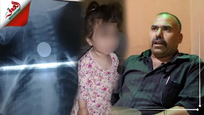 حقوقي: ملف الطفلة إسراء يكشف اهتراء منظومة الصحة بالمغرب.. ويجب فتح تحقيق (فيديو)