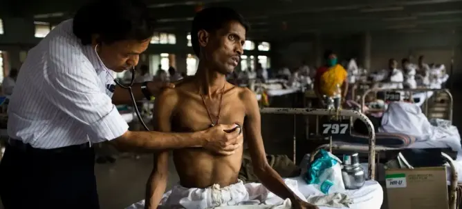 دراسة: توفير العلاج الوقائي من السل للمخالطين وللمصابين بالسيدا سينقذ 850 ألف شخص