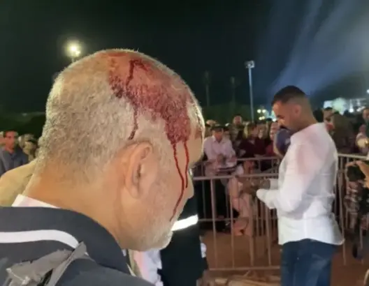 قارورة خمر طائشة تصيب صحافي بمهرجان بيلماون بأكادير