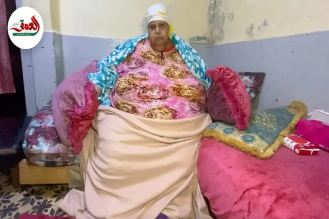تزن أكثر من 300 كلغ.. “أضخم امرأة مغربية” تناشد وزارة الصحة