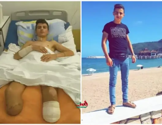 شاب مغربي يتهم الشرطة الصربية بالتسبب في بتر ساقيه.. منشادات لإنقاذه وتحركات لمقاضاة صربيا