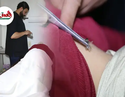 العلاج بسم النحل..أخصائي يكشف أهميته وفوائده ودواعي استعماله