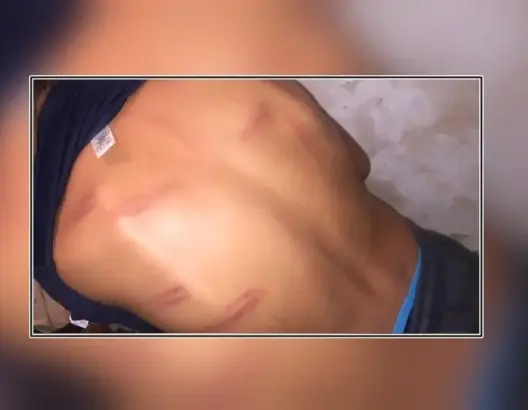 مديرية التعليم بكلميم تفتح تحقيقا في واقعة تعنيف تلميذ من طرف أستاذه