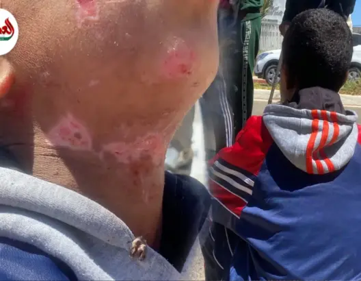 اغتصاب ومحاولة قتل طفل بالزمامرة.. والجاني حر طليق