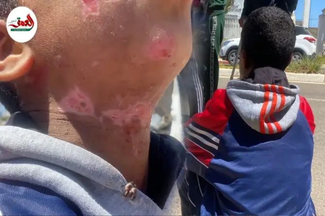اغتصاب ومحاولة قتل طفل بالزمامرة.. والجاني حر طليق