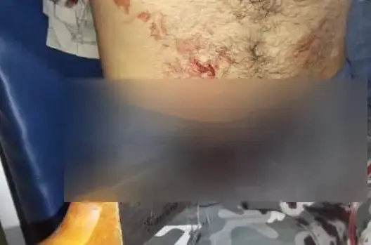 ما حقيقة الحادث الدموي في احتفالات “بوجلود” بأورير شمال أكادير؟