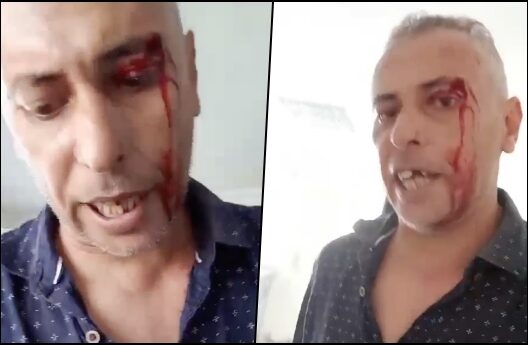 حراس أمن يعتدون على مرتفق بمستشفى "الهاروشي" للأطفال